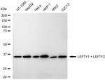 Lefty1/Lefty2 Recombinant Rabbit Monoclonal Antibody (23GB6650)