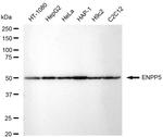 ENPP5 Recombinant Rabbit Monoclonal Antibody (23GB5700)
