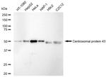 FGFR1OP Recombinant Rabbit Monoclonal Antibody (23GB5705)