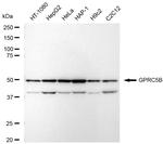 GPRC5B Antibody in Western Blot (WB)