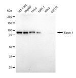 Epsin 1 Antibody in Western Blot (WB)