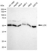 LOX Recombinant Rabbit Monoclonal Antibody (23GB920)