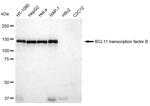 BCL11B Antibody in Western Blot (WB)