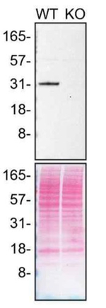 CDK5 Antibody in Western Blot (WB)