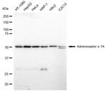 alpha-1a Adrenergic Receptor Antibody in Western Blot (WB)