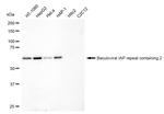 cIAP1 Antibody in Western Blot (WB)