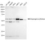 Asparagine Synthetase Recombinant Rabbit Monoclonal Antibody (23GB1475)
