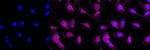 LC3A Recombinant Rabbit Monoclonal Antibody (23GB1960)