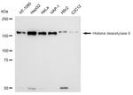 HDAC9 Antibody in Western Blot (WB)