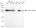INSR Recombinant Rabbit Monoclonal Antibody (23GB2050)