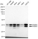 PCBP2 Antibody in Western Blot (WB)