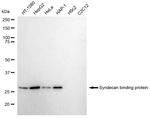 Syntenin 1 Antibody in Western Blot (WB)