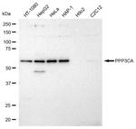 Calcineurin A Antibody in Western Blot (WB)