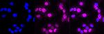 DDB2 Antibody in Immunocytochemistry (ICC/IF)
