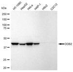DDB2 Antibody in Western Blot (WB)