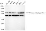 AKAP8 Antibody in Western Blot (WB)