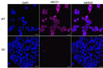 ABCD1 Antibody in Immunocytochemistry (ICC/IF)