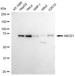ABCD1 Recombinant Rabbit Monoclonal Antibody (23GB3125)