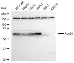 ALAS1 Recombinant Rabbit Monoclonal Antibody (23GB3190)