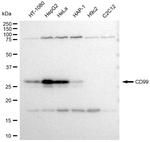 CD99 Recombinant Rabbit Monoclonal Antibody (23GB3395)
