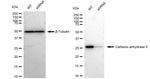 Carbonic Anhydrase II Antibody