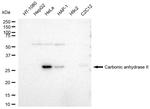 Carbonic Anhydrase II Antibody in Western Blot (WB)