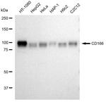CD166 Recombinant Rabbit Monoclonal Antibody (23GB3405)