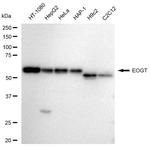 EOGT Recombinant Rabbit Monoclonal Antibody (23GB3585)