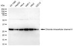 CLIC4 Antibody in Western Blot (WB)