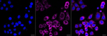 CSDE1 Antibody in Immunocytochemistry (ICC/IF)
