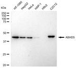 ABHD5 Recombinant Rabbit Monoclonal Antibody (23GB3260)