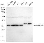 PHAPI2 Antibody in Western Blot (WB)