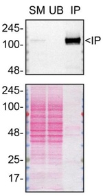GEF-H1 Antibody in Immunoprecipitation (IP)