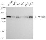 GEF-H1 Recombinant Rabbit Monoclonal Antibody (23GB3675)