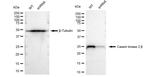 CK2 beta Antibody
