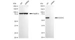 ACADVL Antibody
