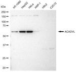 ACADVL Antibody in Western Blot (WB)