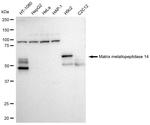 MMP14 Recombinant Rabbit Monoclonal Antibody (23GB2695)