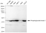 PGK1 Recombinant Rabbit Monoclonal Antibody (23GB2430)