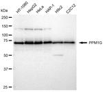PPM1G Antibody in Western Blot (WB)