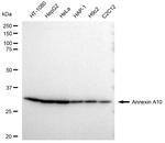 Annexin A10 Antibody in Western Blot (WB)