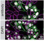 ARID1A Antibody