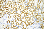 ATP Synthase beta Antibody in Immunohistochemistry (Paraffin) (IHC (P))