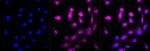 NG2 Recombinant Rabbit Monoclonal Antibody (23GB3470)