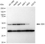 DEK Antibody in Western Blot (WB)