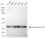 Phospho-CDK2 (Tyr15) Antibody in Western Blot (WB)
