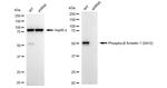 Phospho-beta Arrestin 1 (Ser412) Antibody