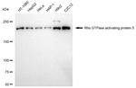 ARHGAP5 Antibody in Western Blot (WB)