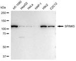 SPINK5 Antibody in Western Blot (WB)