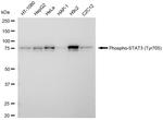 Phospho-STAT3 (Tyr705) Antibody in Western Blot (WB)